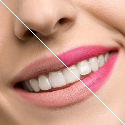 COMING SOON Inuwet Magischer PH-Lippenstift pink Strawberry